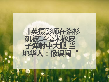 英摄影师在洛杉矶被14毫米橡皮子弹射中大腿 当地华人：像误闯“末日生存”游戏